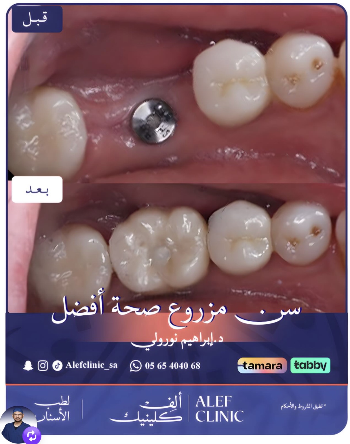 قبل وبعد
