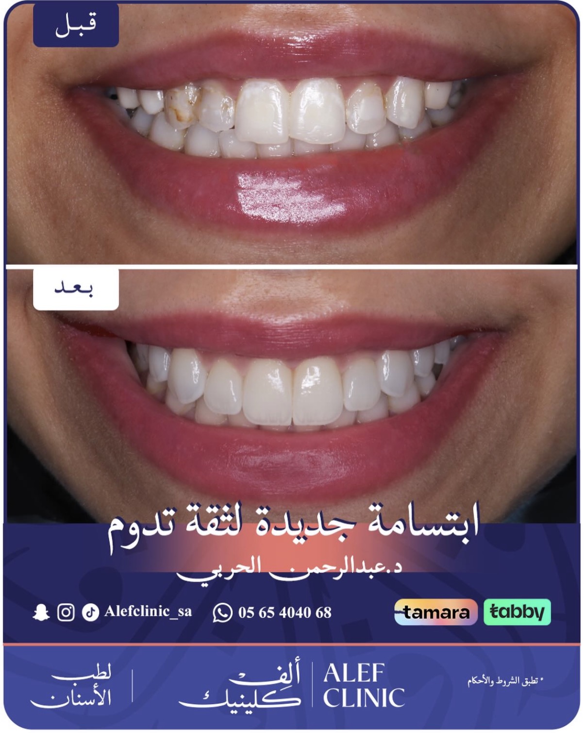 قبل وبعد